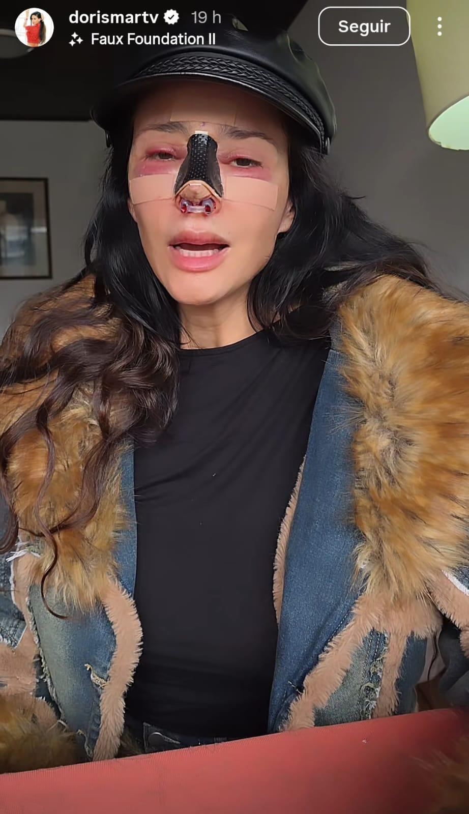 Dorismar queda “irreconocible” tras fallidos procedimientos estéticos