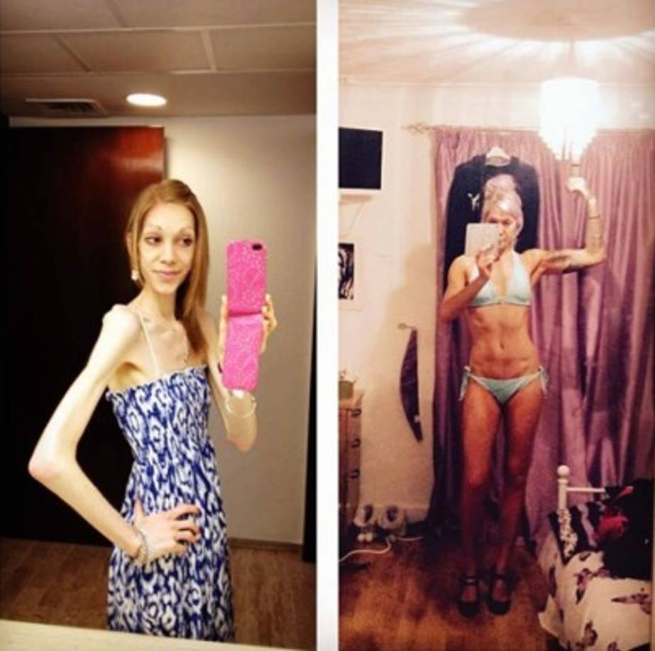 Pero no fue hasta el año 2015 que realmente deseó aumentar su masa muscular. En su proceso de recuperación, dentro de un gimnasio, conoció el fisicoculturismo y a partir de allí cambió su vida.