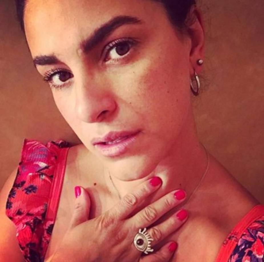 'Yo elegí mal. Yo confié en alguien que no se lo merecería. Y estoy pagando las consecuencias de eso con un precio muy alto que será de por vida el costo. Sufrí daños irreversibles en mi cara en el área de las cejas', ha contado la actriz.