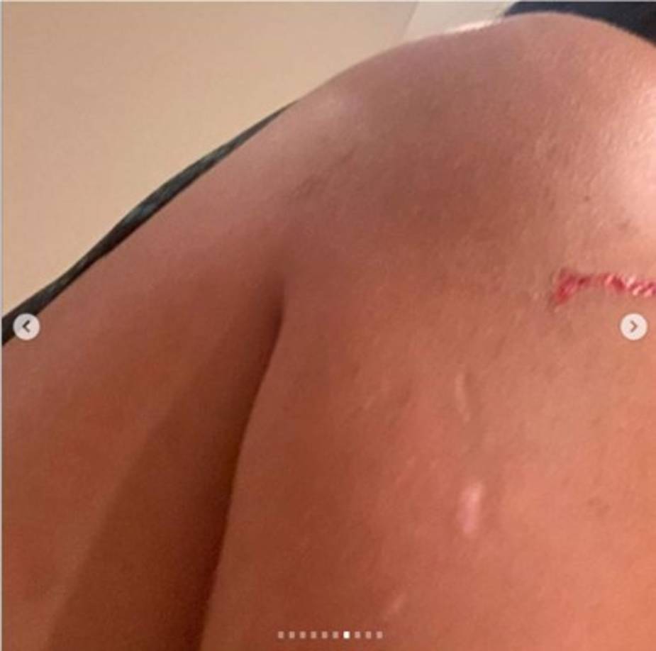 Daniela Cortés sufrió heridas en su cuerpo por los golpes que le propinó el jugador de Boca.