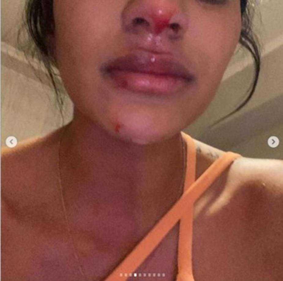 Daniela Cortés acusó a Sebastián Villa de ser “un maltratador tanto físico como psicológico y mucha gente está de testigo”.