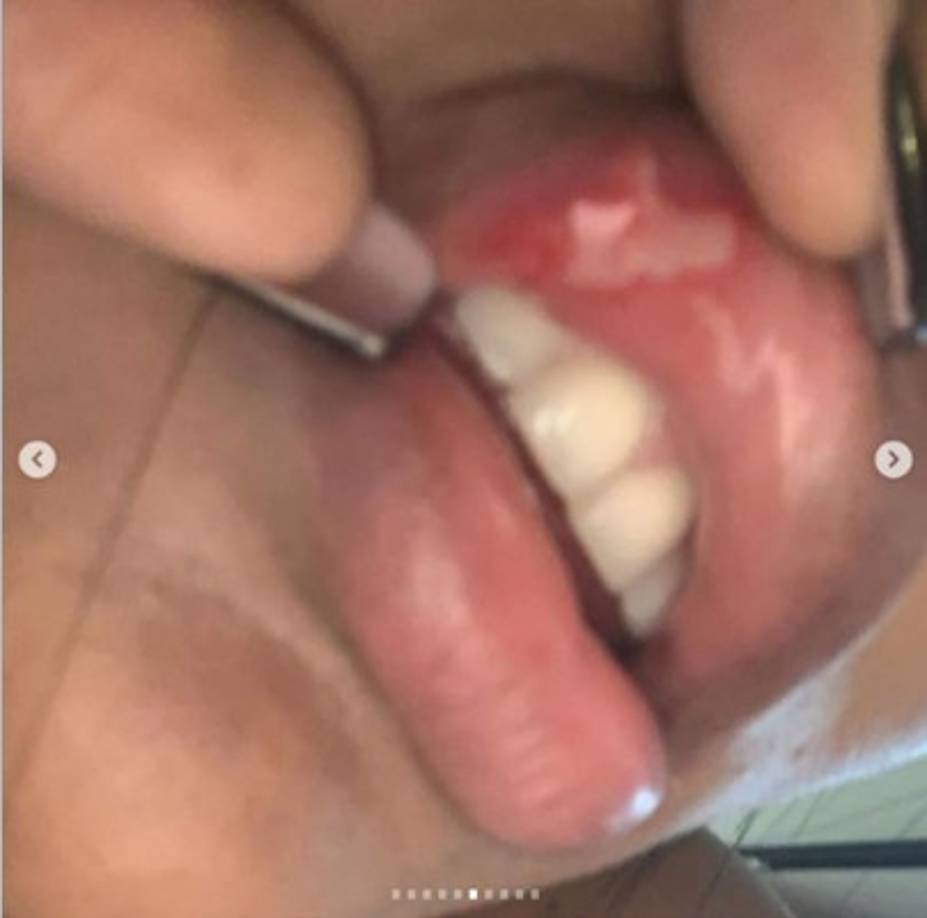 La novia de Villa añade: “No entiendo una persona “profesional” como es capaz de hacer tanto daño y que porque tiene malas amistades solo se dedica amenazar y humillar, siento un dolor muy grande tener que estar en un país que no conozco y donde estoy sola, sin mi familia, y no poder viajar y salir corriendo con miedo que pase algo con mi vida y la de mi familia”.