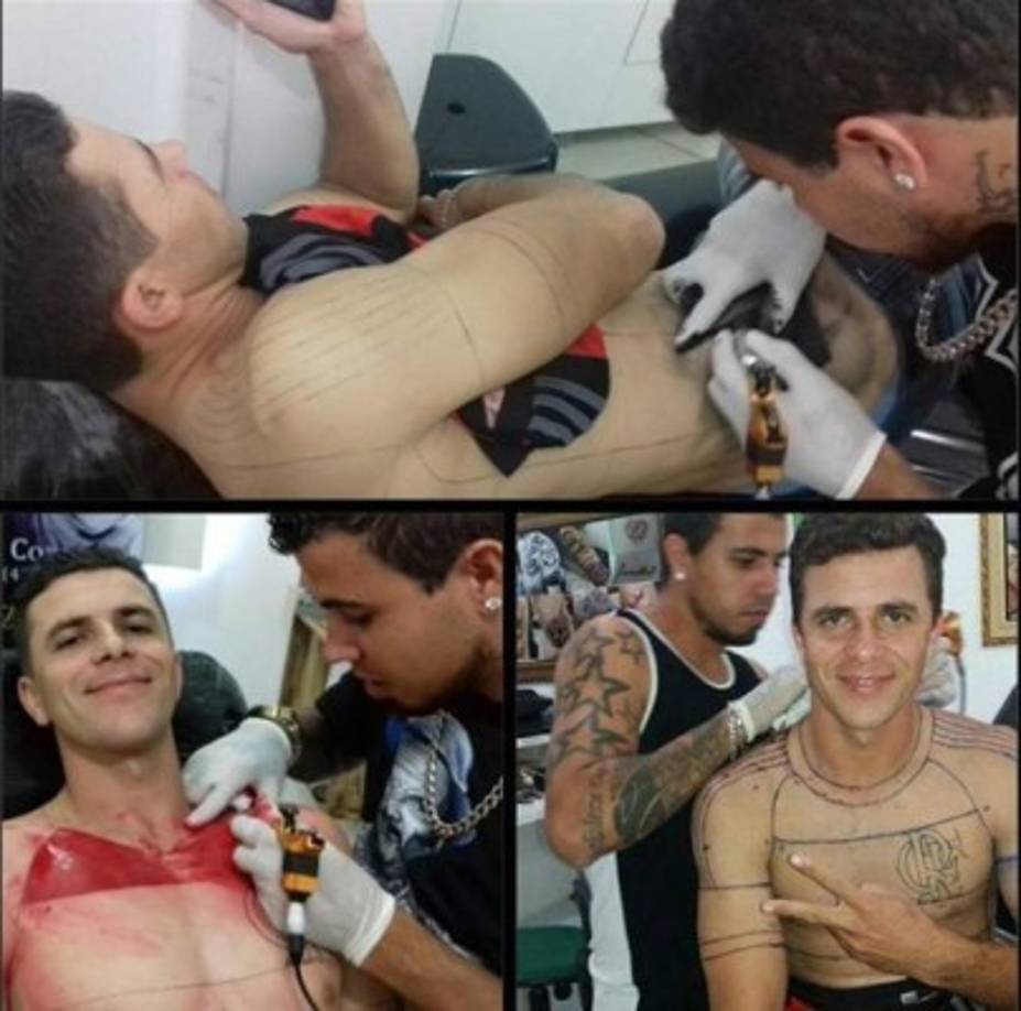 En esta fotografía se exponen diferentes tomas del proceso al que en un inicio fue sometido el fanático del Flamengo.