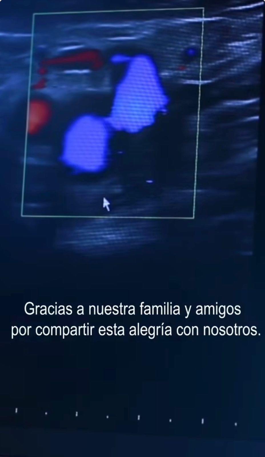 Diputada Erika Urtecho y Daniel Esponda anuncian que serán padres