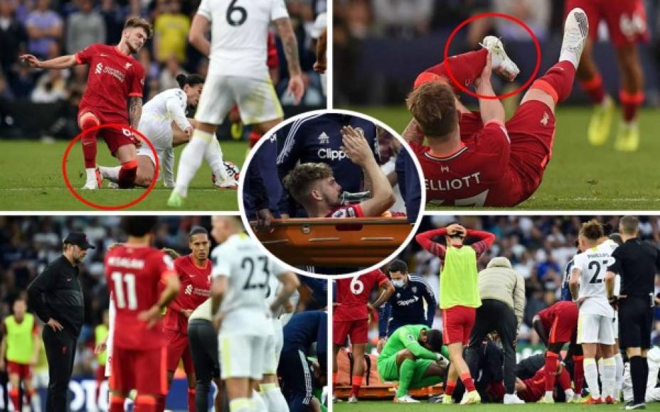 Las imágenes de la escalofriante lesión que sufrió el joven futbolista inglés Harvey Elliot del Liverpool en el partido contra el Leeds United por la Premier League.