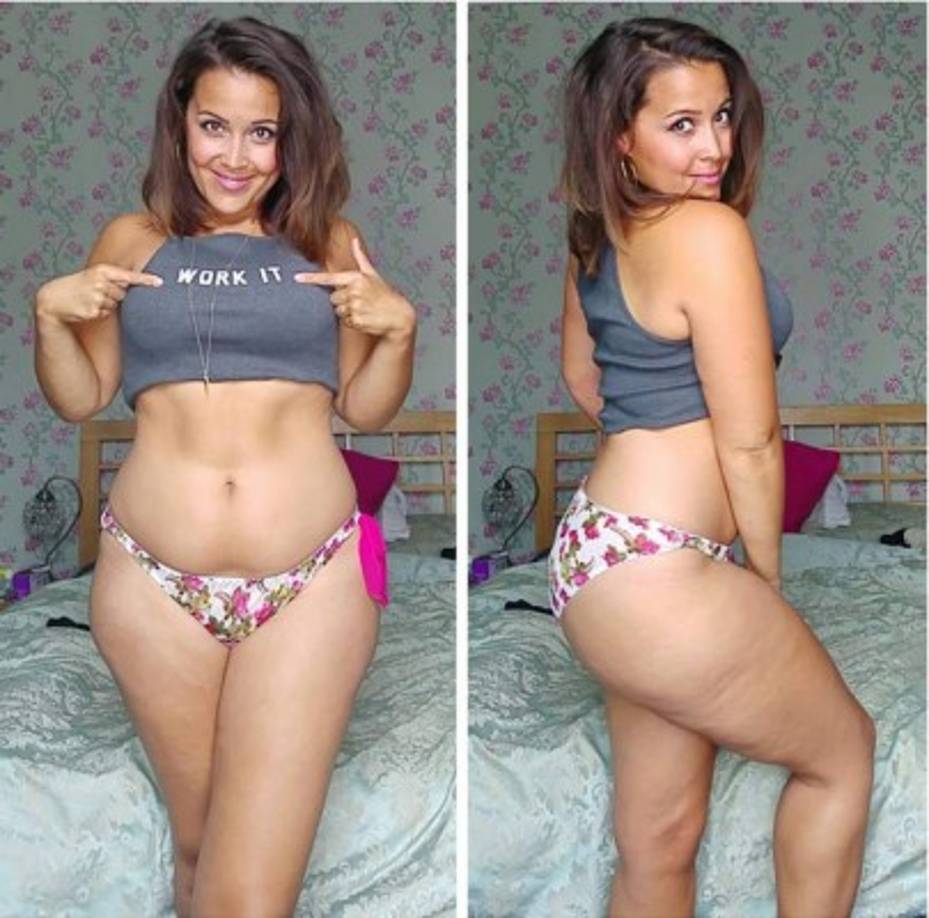 “Si puedo enamorarme de mi cuerpo después de todo lo que ha pasado, cualquier persona puede, sólo tiene que creer que lo merece', dice la joven.