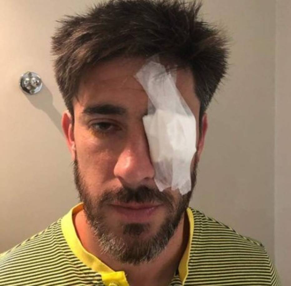 Varios jugadores xeneizes, entre ellos el capitán Pablo Pérez, resultaron con laceraciones en los rostros y los brazos producto de los vidrios rotos y los artefactos peligrosos que ingresaron al micro.