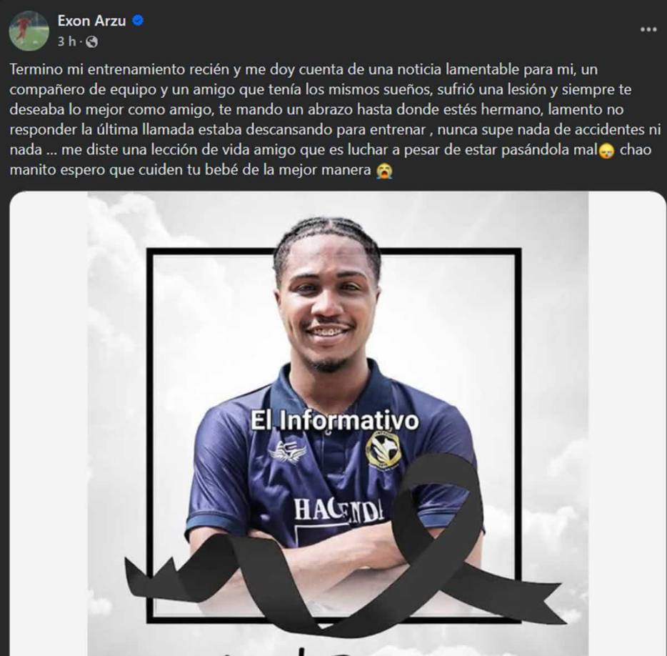 “Termino mi entrenamiento recién y me doy cuenta de una noticia lamentable para mí. Un compañero de equipo y un amigo que tenía los mismos sueños, sufrió una lesión y siempre te deseaba lo mejor como amigo. Te mando un abrazo hasta donde estés hermano, lamento no responder la última llamada”, compartió Arzú en Facebook.