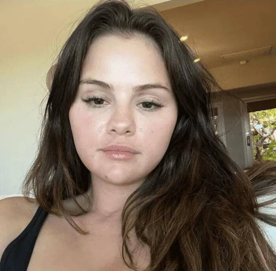 Selena Gómez es una cantante, actriz, productora, diseñadora y empresaria estadounidense.Inició su carrera como actriz a los 10 años con el papel secundario de Gianna en la serie infantil “Barney y sus amigos”. Apareció en Hanna Montana y otras series hasta que, en 2007, estrenó su propia ficción, llamada “Los hechiceros de Waverly Place”. En esta fotografía muestra su piel morena y tersa, con algunas marcas de acné. 