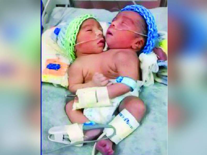 <b>La travesía de estos recién nacidos apenas comienza y su futuro está en manos de especialistas.</b>