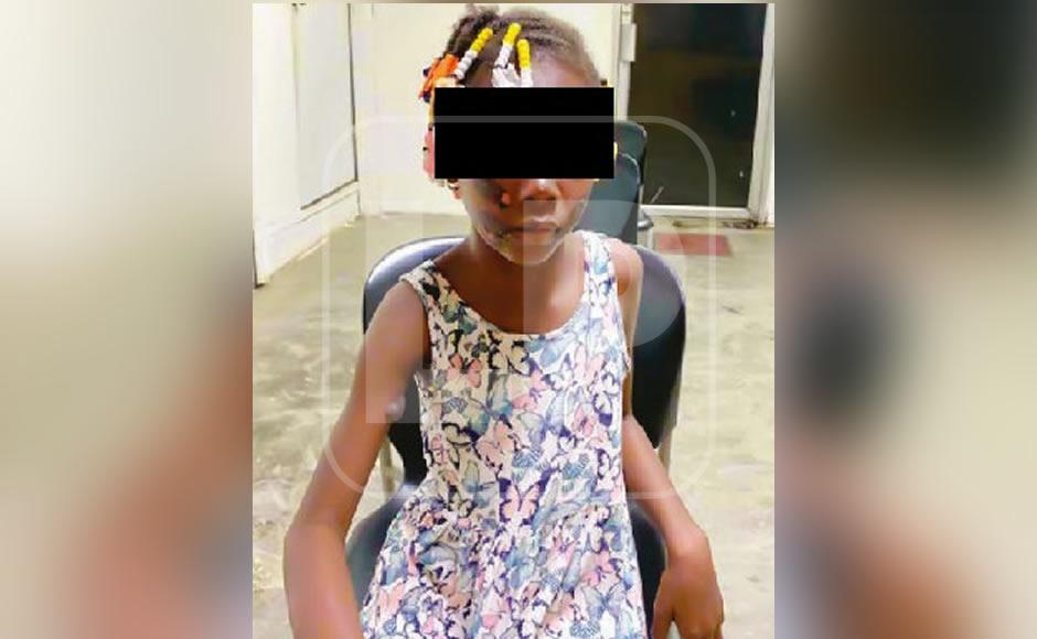 Mandan a la cárcel a mujer que quemó a su hija con agua caliente como castigo