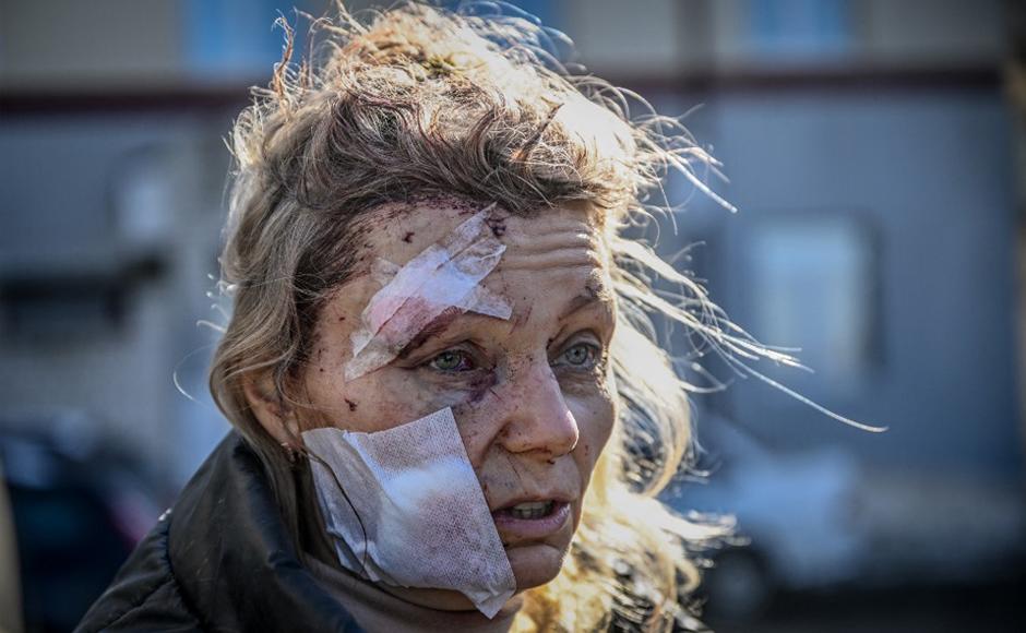 Una mujer herida se encuentra frente a un hospital después del bombardeo de la ciudad de Chuguiv, en el este de Ucrania.