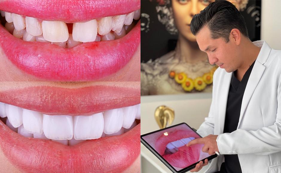 Tecnología y experiencia, claves para un buen diseño de sonrisa según Álamo Rodríguez