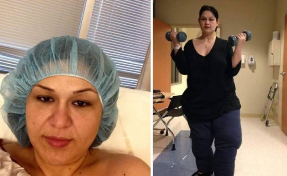 Mayra recibió un cirugía de bypass gástrico donde perdió la mayoría de su peso.