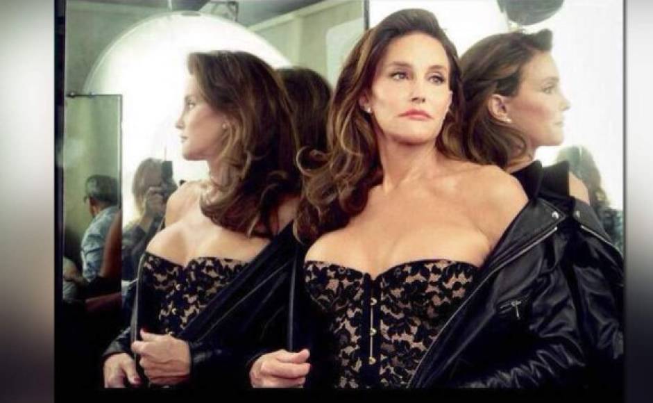 Jenner todavía no se ha sometido a la cirugía genital pero, además de un tratamiento hormonal, ha pasado por un proceso de cirugía de feminización facial de 10 horas en el que, según revela el reportaje de 22 páginas, sufrió un ataque de pánico.