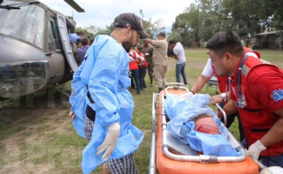 Tres menores de edad fueron trasladadas desde Yoro en helicóptero para ser atendidas en el hospital Mario Rivas.