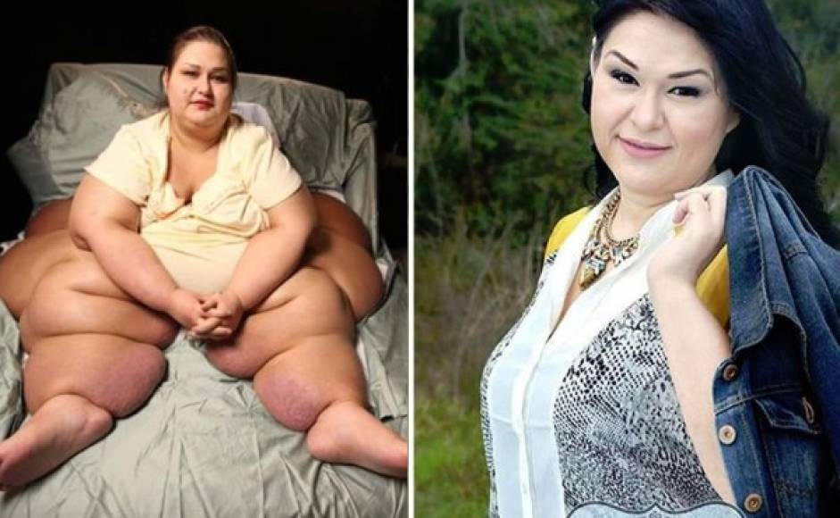 Mayra Rosales llego a pesar mas de 1,000 libras convirtiéndose así en una de las mujeres mas gordas del mundo.