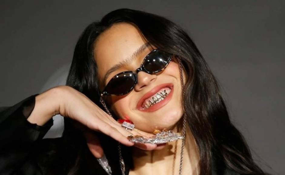 Rosalía y su polémico look de dientes de oro, otro robo cultural