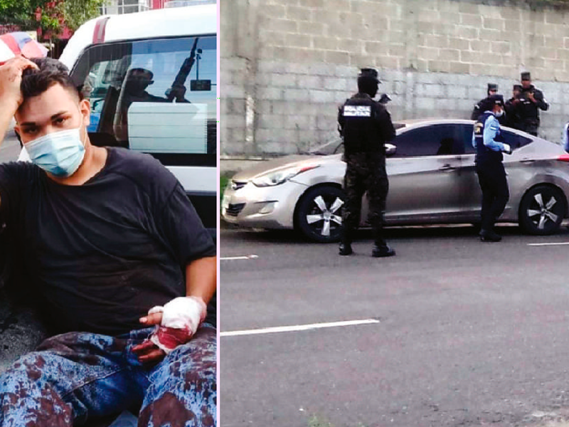 Como Abel Enrique Coto fue identificado el supuesto responsable del asalto, el carro en el que huyó fue decomisado por la Policía.