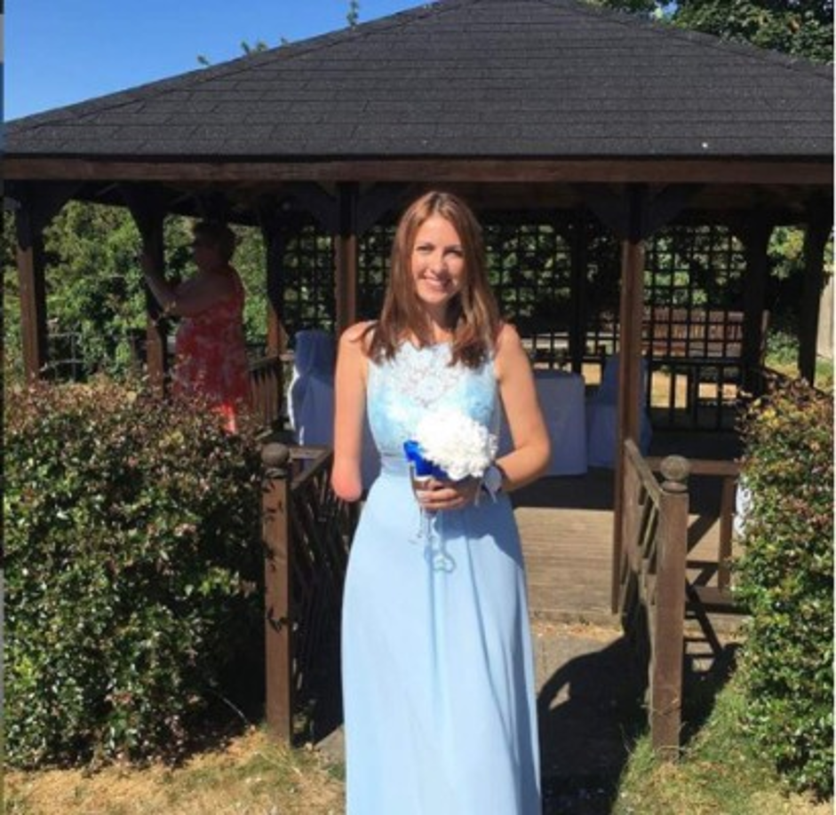 Disabilityhorizons.com también le preguntó sobre los comentarios que ha recibido por su discapacidad, ella contestó:' he tenido una mezcla real de comentarios, el 99% de los cuales han sido positivos. Mucha gente ha dicho que les parece inspirador o refrescante verme en la pantalla, y que apoyan lo que estoy haciendo. También ha habido mucho interés en lo que sucedió exactamente en mi mano.Lamentablemente, como siempre con una carrera en los medios, he tenido algunos comentarios desagradables. Pero han sido pocos y distantes entre sí'.