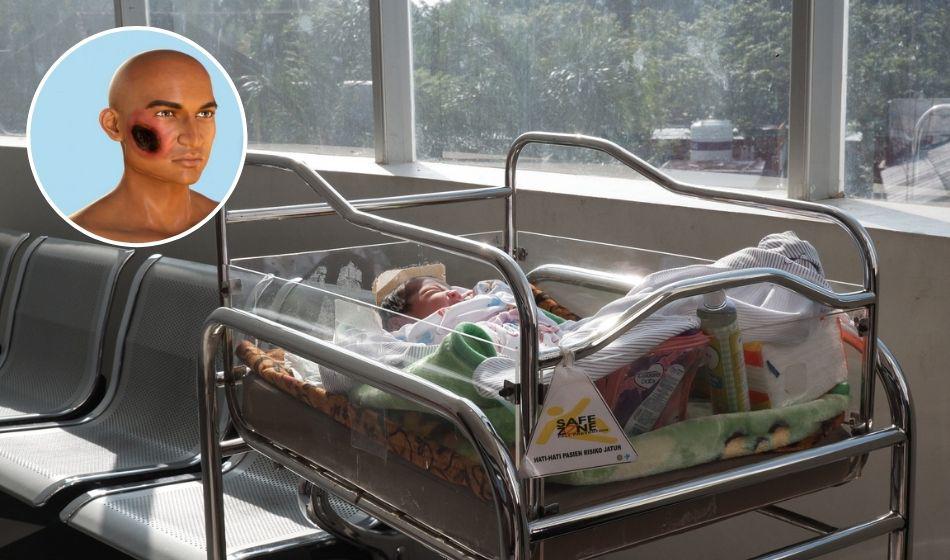 Investigan muerte de recién nacido por sospecha de hongo negro