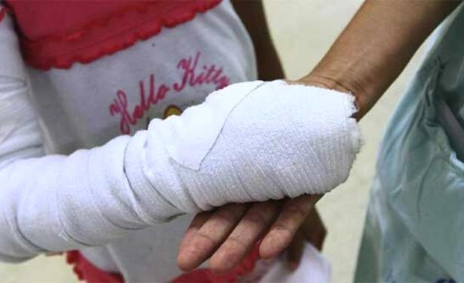 Suman 17 los niños quemados por reventar cohetes