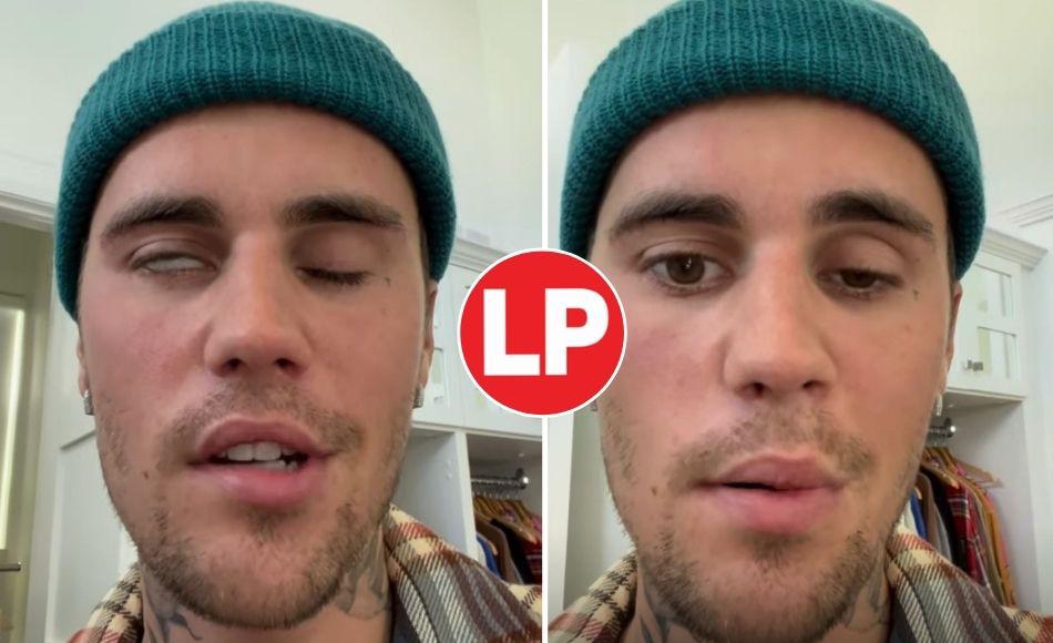 Justin Bieber muestra su rosto afectado tras sufrir parálisis facial
