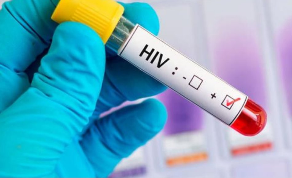 Más de 2,000 casos de VIH reportan autoridades del SAI en La Ceiba