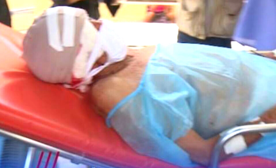 Anciano gravemente herido tras sufrir ataque de un perro en Choluteca