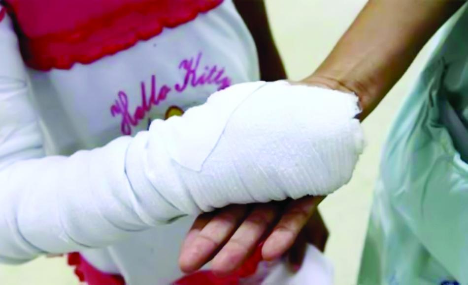 Festividades dejan 27 quemados por pólvora en la zona norte