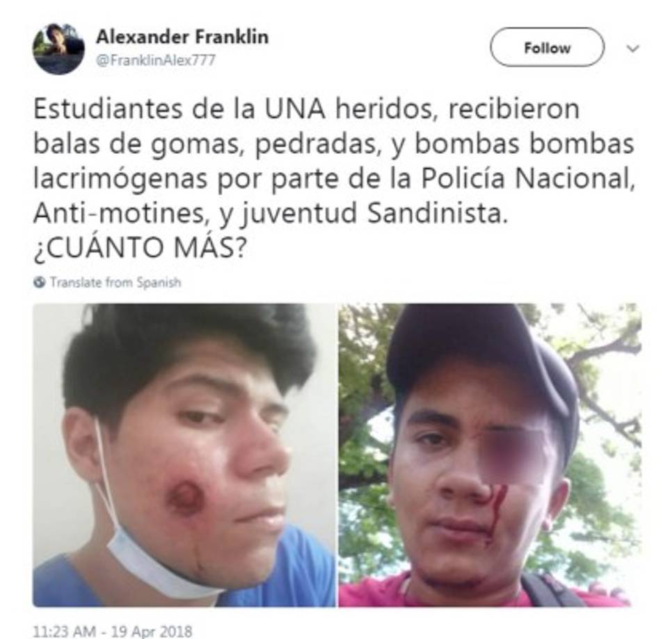 En redes sociales, los manifestantes han divulgado las dramáticas imágenes de los heridos en las protestas.