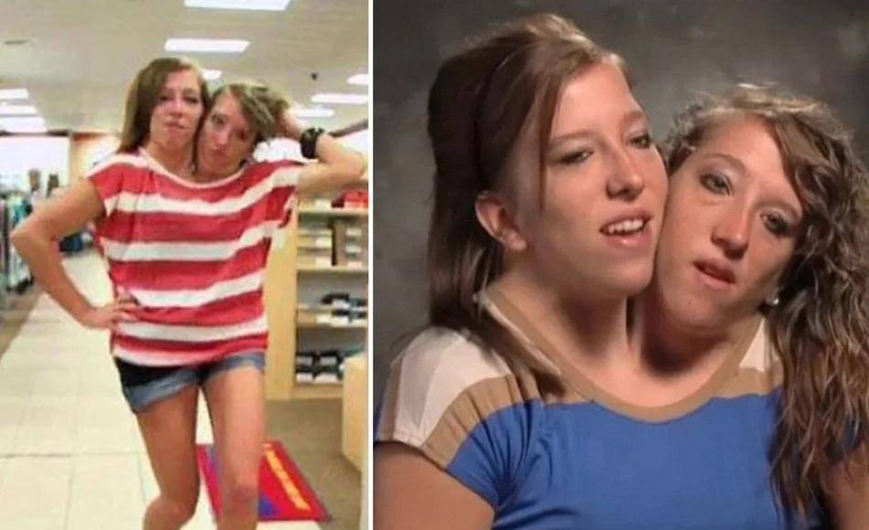 “Son chicas guapas. Son ingeniosas. Tienen todo a su favor, excepto que están juntas”, dijo Mike.