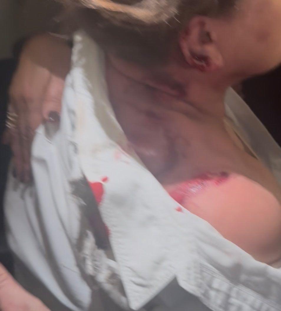 “Salí impulsada por los aires”: Gladis Aurora López relata momento de la agresión