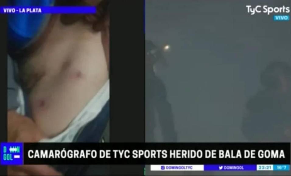 Un camarógrafo de TYC Sports resultó afectado.