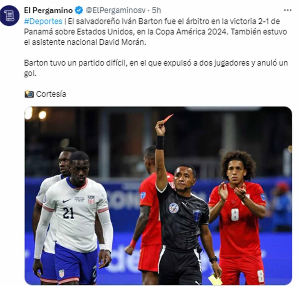 El diario El Pergamino de El Salvador destacó que Iván Barton “tuvo un partido difícil, en el que expulsó a dos jugadores y anuló un gol”. 
