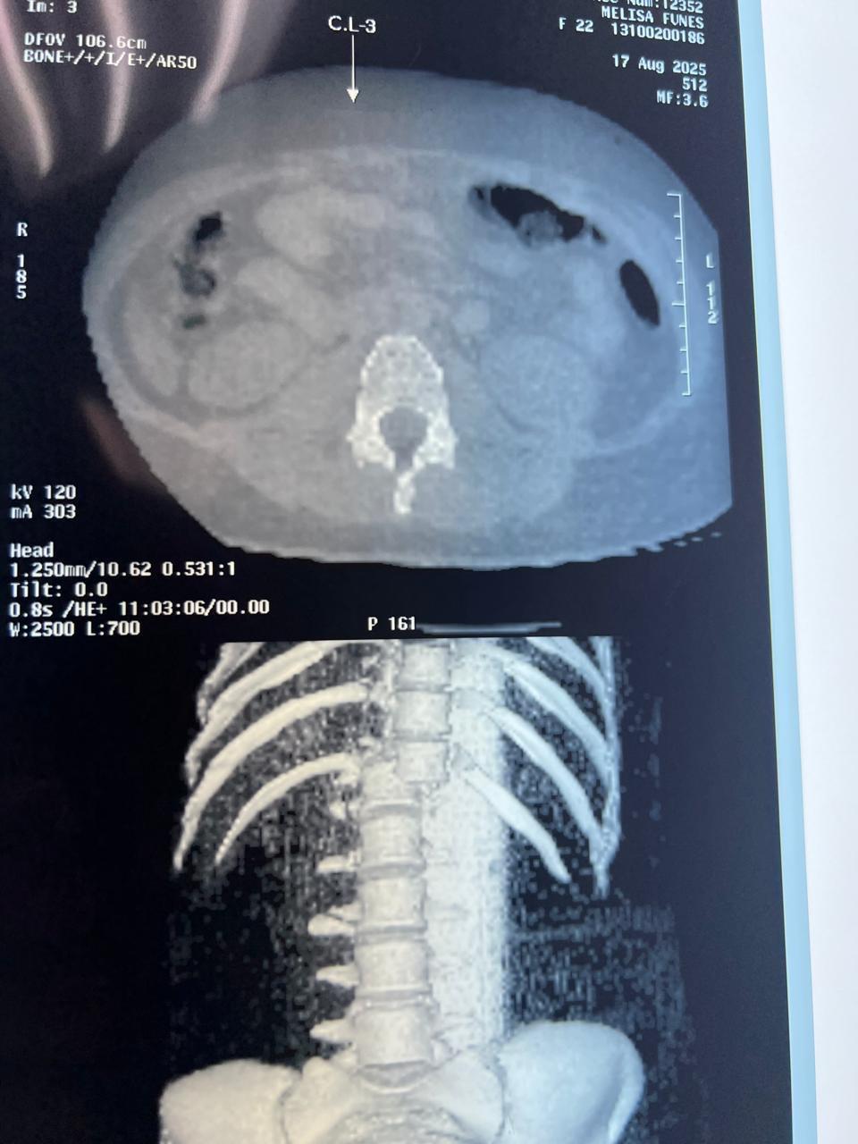 Joven madre se cae de la rueda de Chicago en Copán; denuncian abandono de los dueños