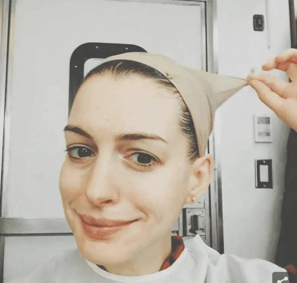 Anne Hathaway es una actriz estadounidense. Ganó el premio Óscar, el Globo de Oro, el BAFTA y el SAG a la mejor actriz de reparto por su interpretación en “Los miserables”. En la foto sin filtros ni maquillajes, su piel luce pálida y lisa. Con unas leves ojeras y cejas finas y oscuras. 