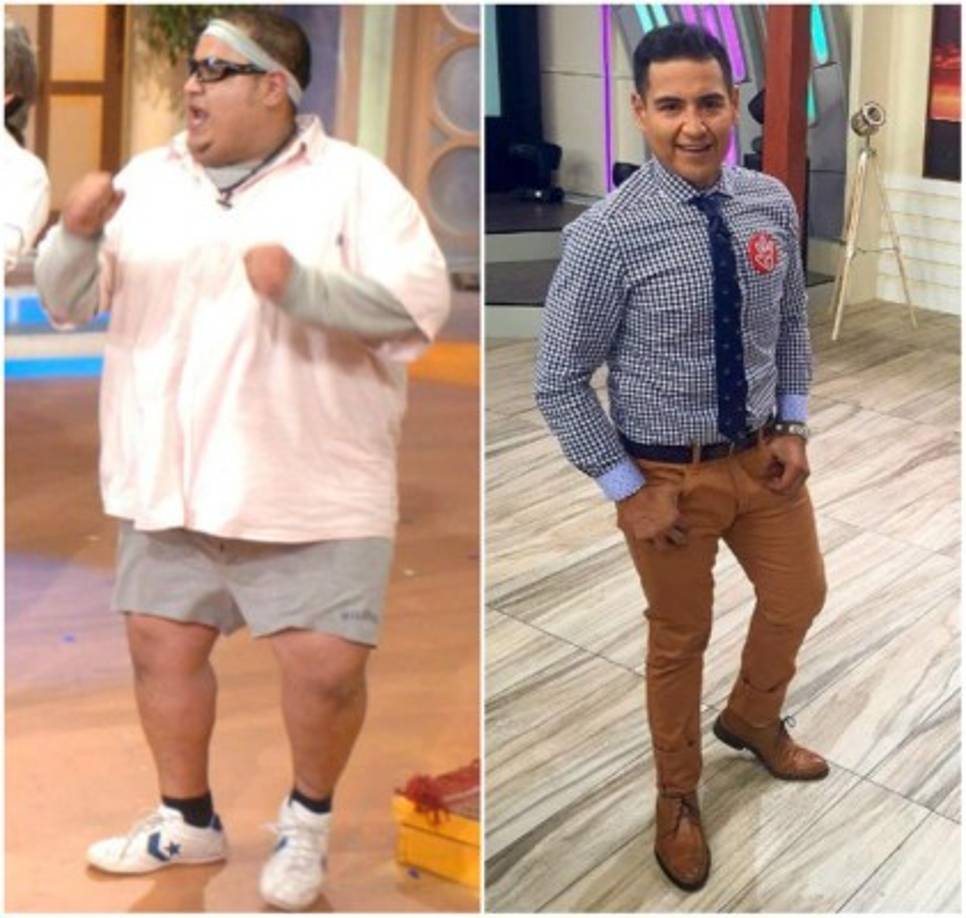 Como era de esperar el exceso de piel no pudo reducirse con ejercicios, así que el conductor mexicano se ha sometido a varias operaciones para retornar su piel a su estado original, esto incluyó la de su rostro.<br/>