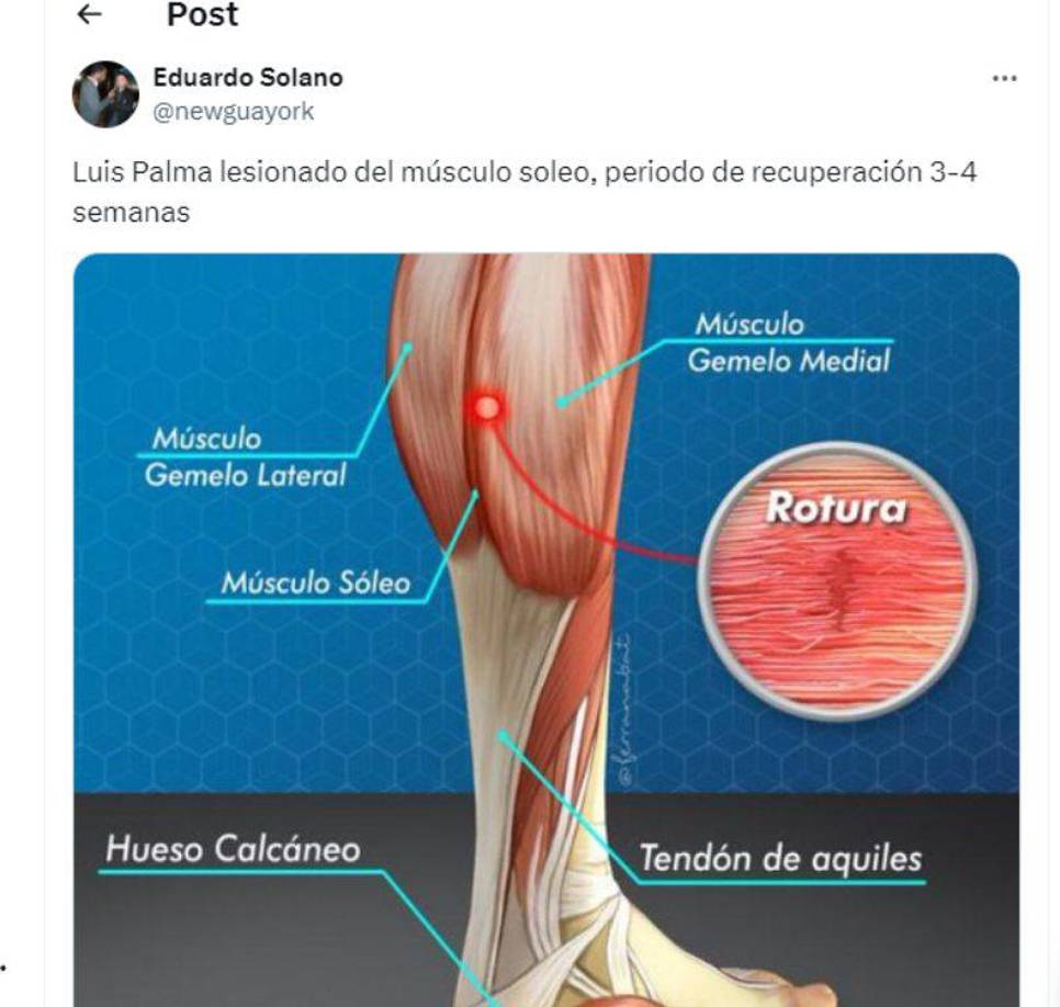 Alivio en Costa Rica y consternación en Honduras por Luis Palma