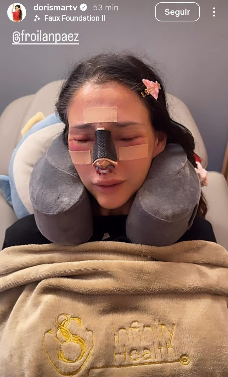 Dorismar queda “irreconocible” tras fallidos procedimientos estéticos