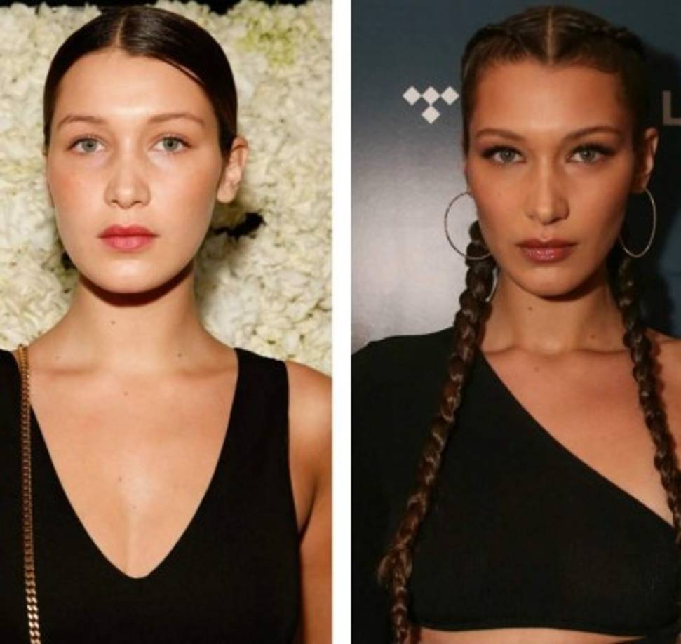 Aunque ella ha dicho que le 'aterra' pasar por el quirofoano e incluso inyectarse el rostro, las fotos del antes y después muestran que la modelo más 'perfecta' se realizó una rinoplastia para perfilar su nariz y la bichectomia para reducir el tamaño de sus mejillas.