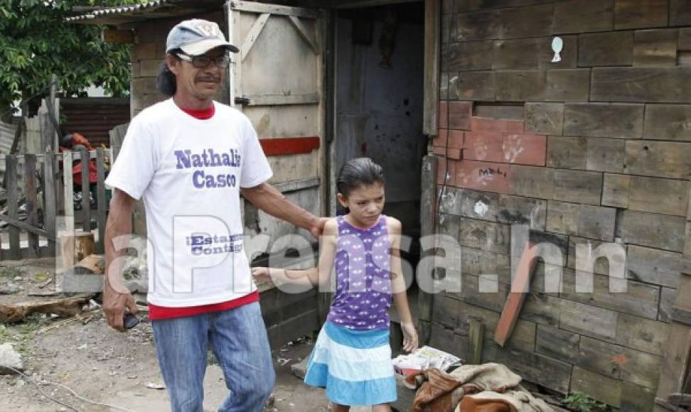 El papá de Nathalia, José Fernando Casco junto a su hija menor.
