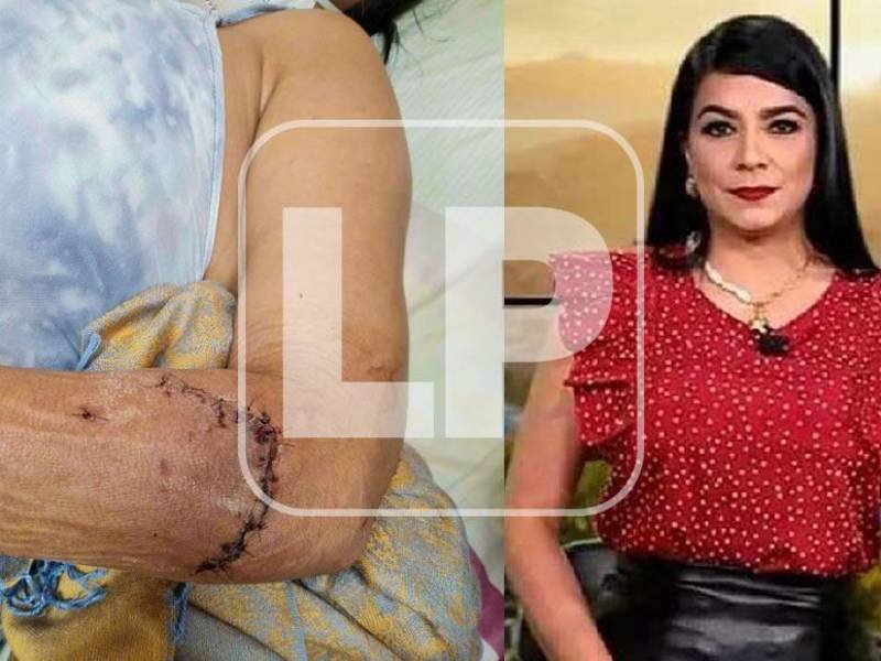 Se recuperó físicamente, pero Mejía enfrenta las secuelas emocionales. Cortesía.