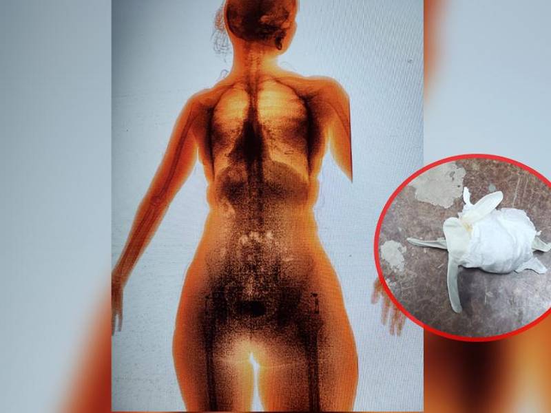 Radiografía de la mujer al momento en que le rastrearon el paquete.