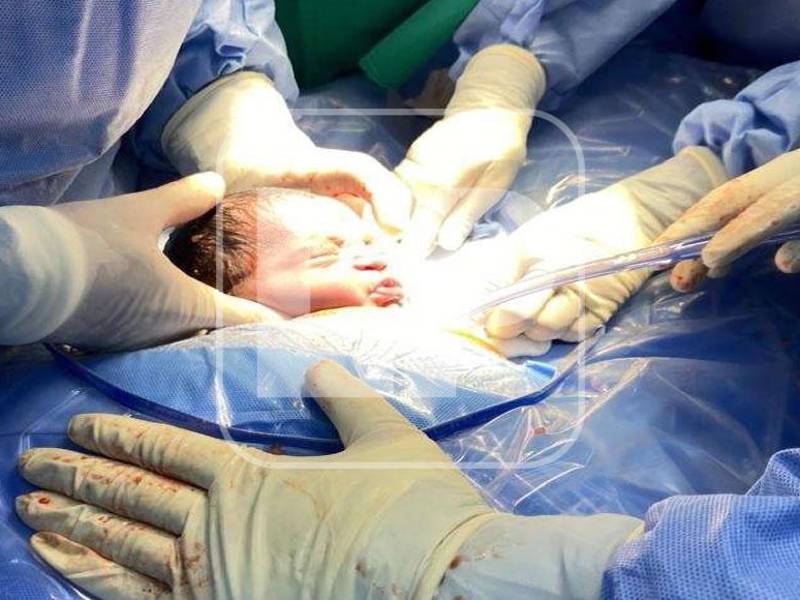 María del Milagro es la primera niña que nació con esta técnica. El tratamiento duró casi cinco años. Fotos: Amílcar Izaguirre.