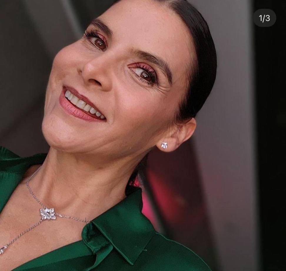 La actriz compartió a sus seguidores que, luego de su accidente, perdió bastante masa muscular. Sin embargo, este no era motivo de tristeza, dado que buscará recuperarla en los próximos meses.