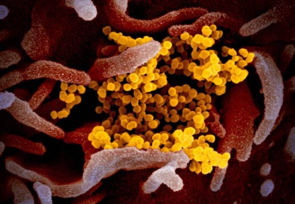Esta imagen de microscopio electrónico de barrido muestra SARS-CoV-2 (amarillo), también conocido como 2019-nCoV, el virus que causa COVID-19, aislado de un paciente en los EE.UU., que emerge de la superficie de las células (rosa) cultivadas en el laboratorio.
