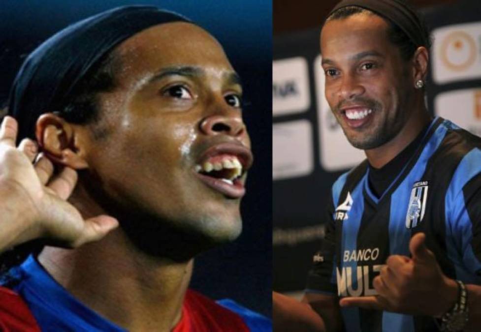 Además de por haber sido uno de los mejores futbolistas del planeta, Ronaldinho era mundialmente conocido por su peculiar dentadura. La operación estética del gaucho costó nada menos que 50.000 euros.