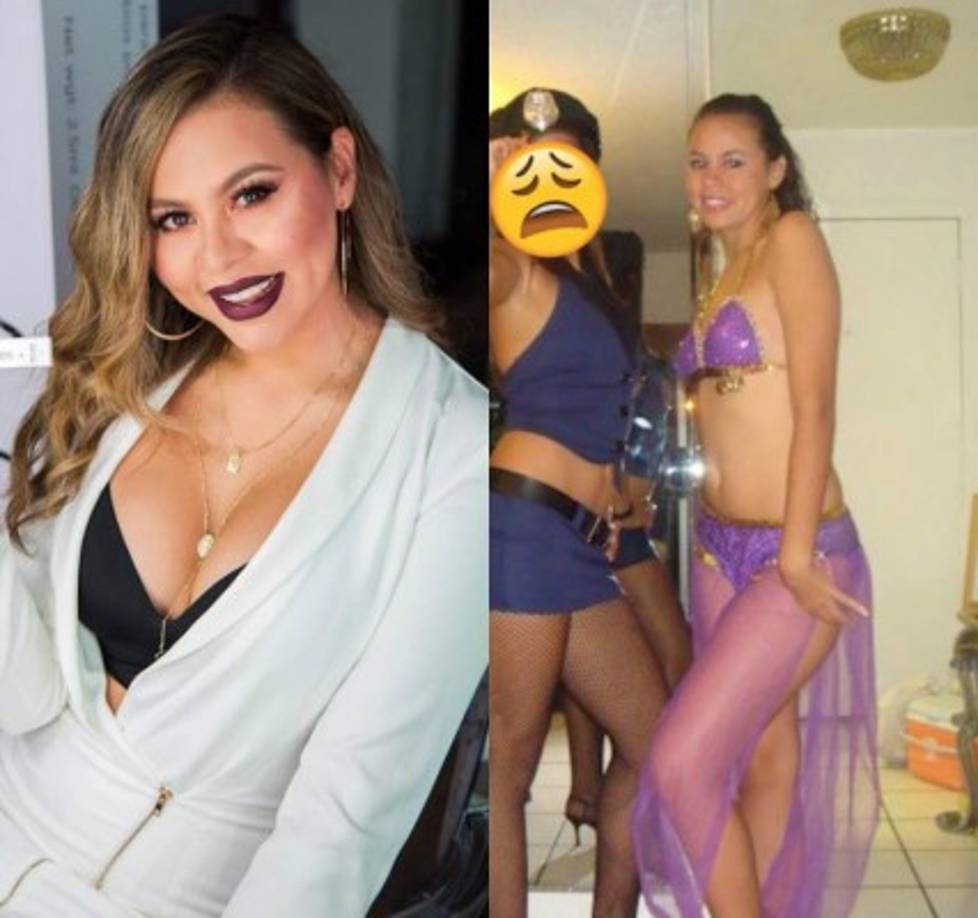 Anteriormente la hondureña ha compartido sus otras cirugías, como el aumento de senos.