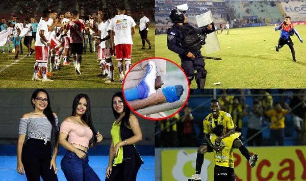 Las imágenes que dejaron los partidos de la quinta jornada del Torneo Apertura 2019 de la Liga Nacional de Honduras.